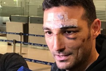 Lionel Scaloni regres al pas y habl del accidente que sufri: "Me com el auto entero"