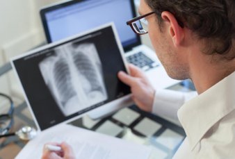 Argentina lidera el registro latinoamericano de una enfermedad pulmonar grave