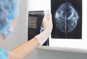 Advierten que es muy desigual el acceso a los controles para prevenir el c�ncer