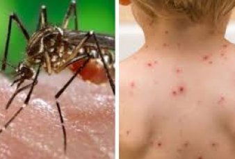 Cumbre de ministros de Salud: preocupan dengue y sarampin