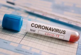 Llegan 45.000 kits desde China y se triplican los testeos