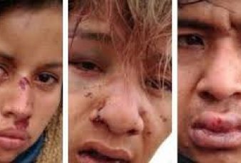 Chaco: apartan a policas por una brutal agresin a una familia Qom