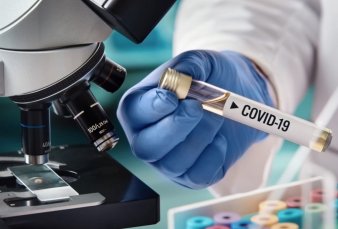 Usan suero de caballos para producir un suero que podr�a neutralizar al Covid-19