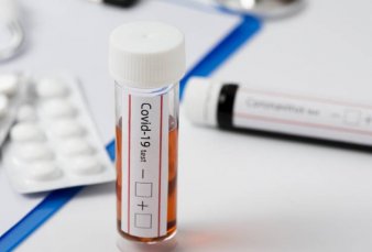 Con 417.735 casos, el pa�s entr� en el top ten mundial