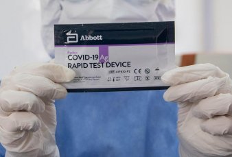 El Gobierno present� nuevos test r�pidos para detectar contagiados